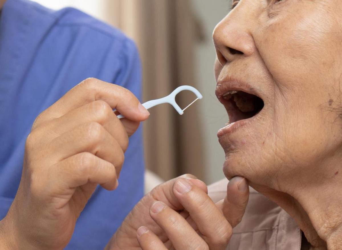Alzheimer : la parodontite chronique à l'origine de protéines toxiques