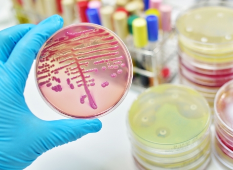 Antibiorésistance : un surcoût estimé à 290 millions d'euros sur deux ans