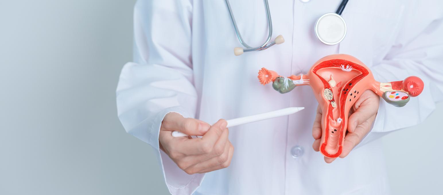 SOPK : vers des traitements plus ciblés contre le dysfonctionnement endométrial ? 