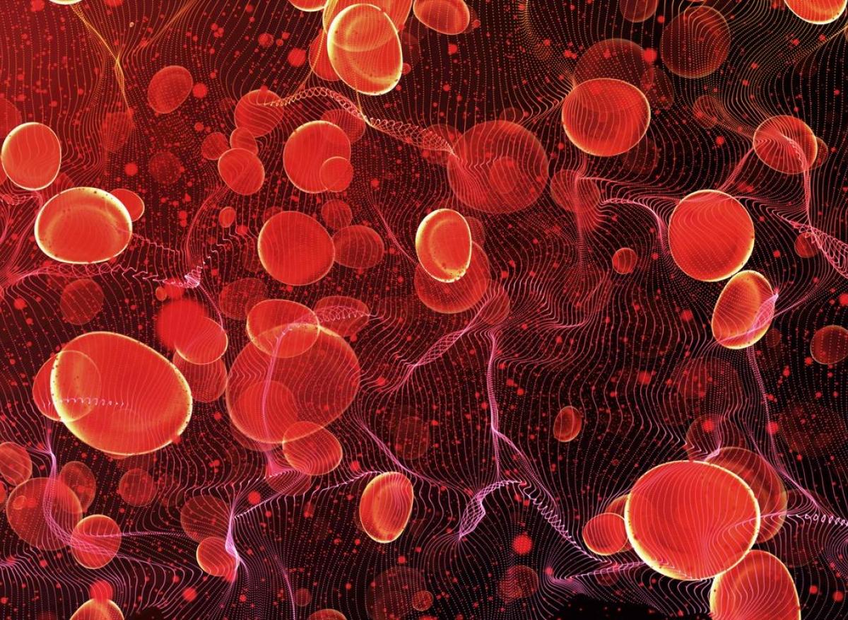 SLA : des niveaux élevés de métaux dans le sang et l’urine chez certains malades