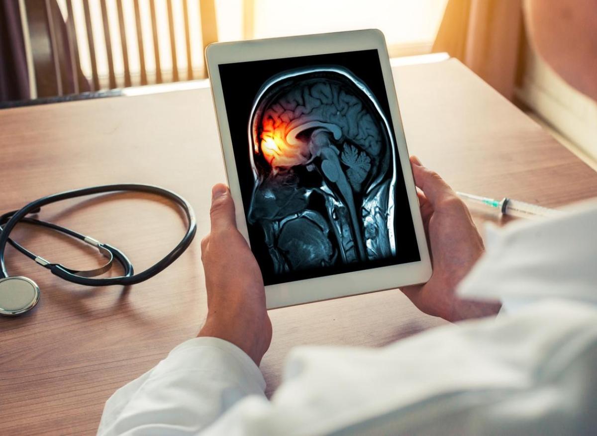 Méningite : recrudescence importante, selon Santé Publique France 