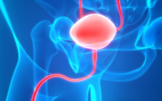 Cancer de la vessie métastatique : intérêt de l’immunothérapie en maintenance