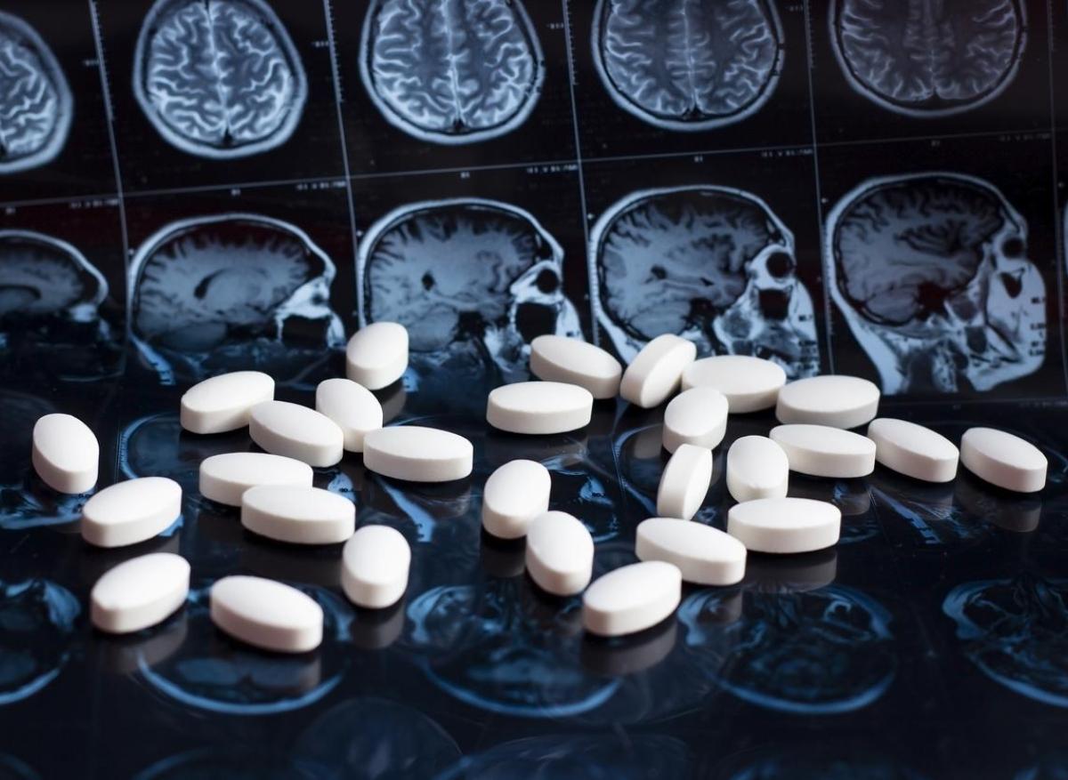 Alzheimer : un anti-amyloïde finalement approuvé par l’Europe ?
