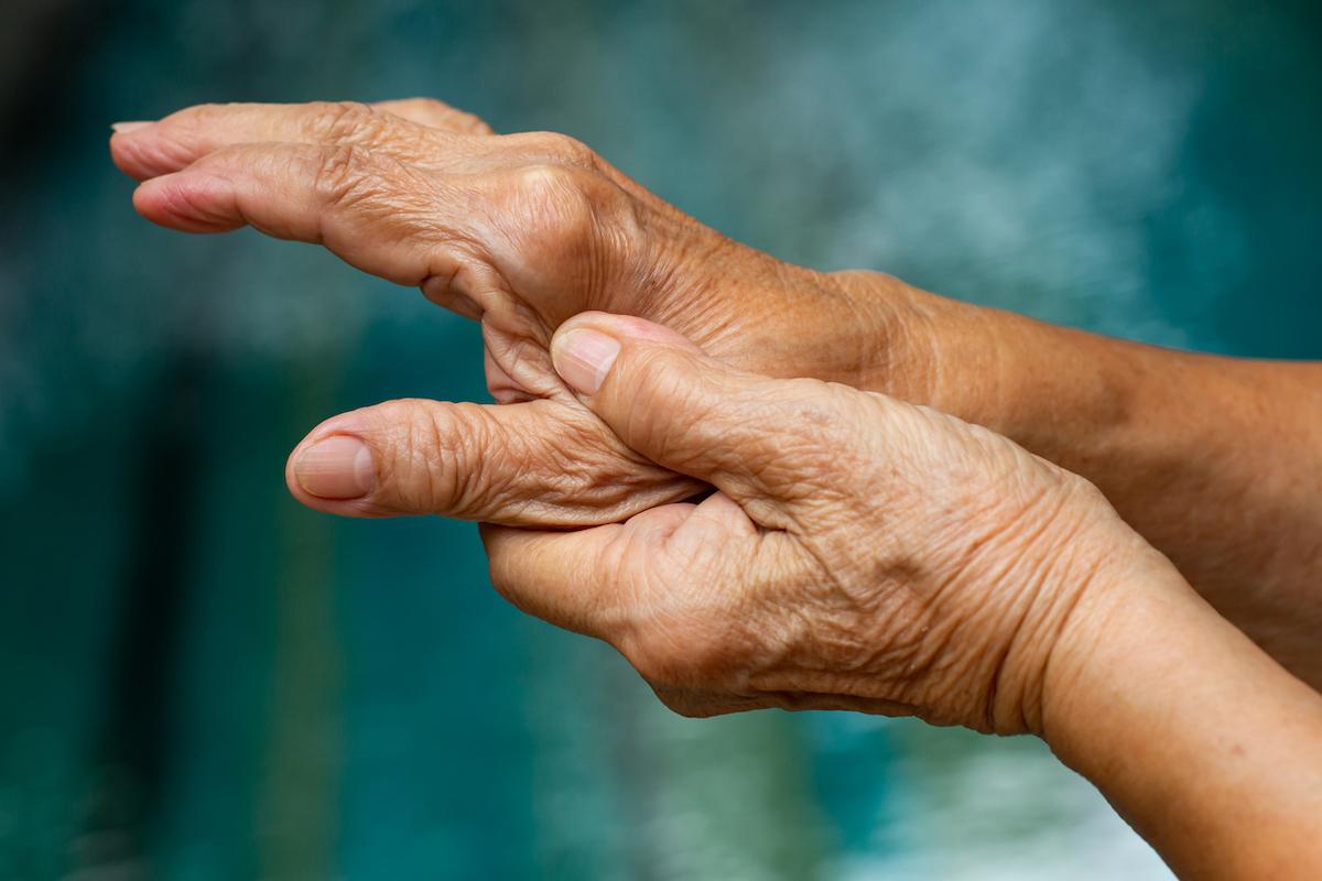 Arthrose des mains : le syndrome métabolique aggrave bien la douleur d’arthrose digitale