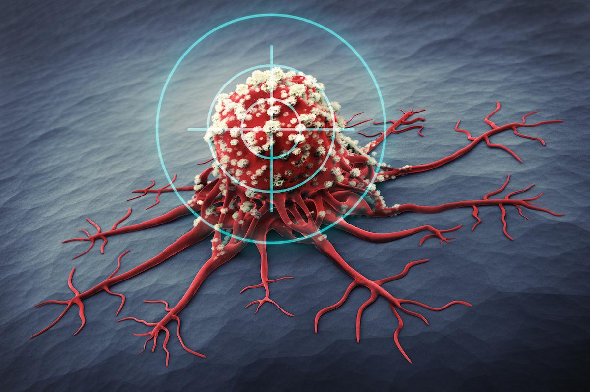 Cancers digestifs métastasés : une nouvelle immunothérapie révolutionnaire 