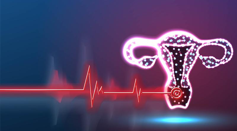 Diabète de type 2 : quel est le risque lié au syndrome des ovaires polykystiques ?