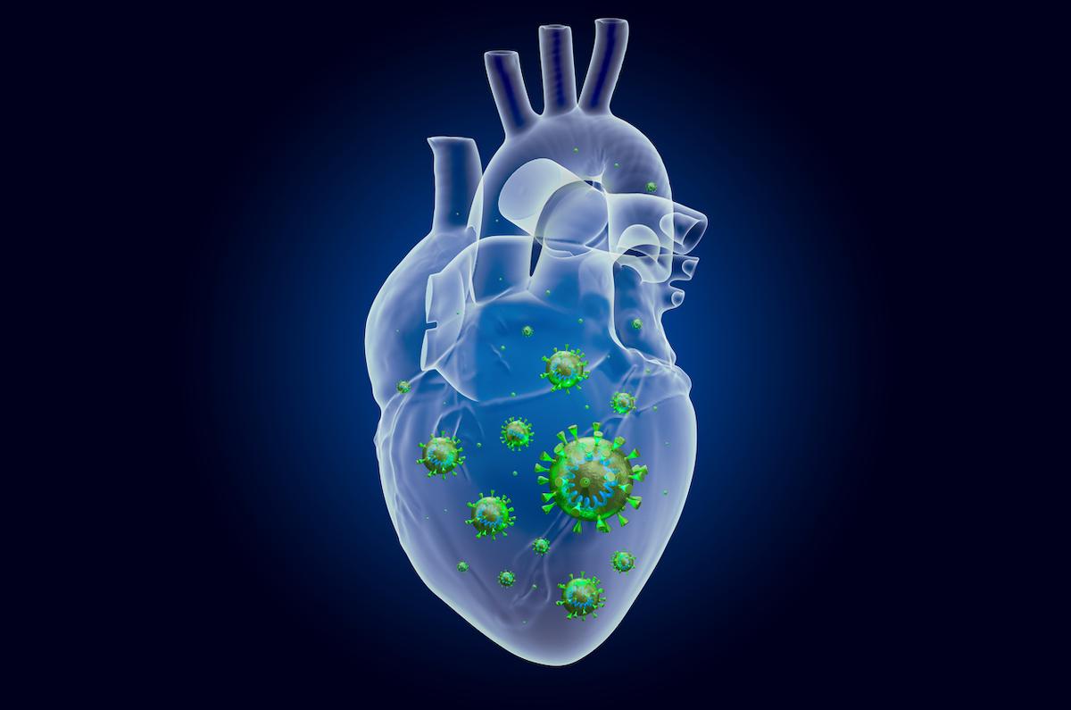 Covid-19 et risque cardiovasculaire : il persiste longtemps après la fin de l’infection