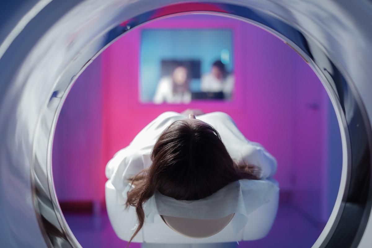 SEP et syndrome radiologique isolé : y a-t-il des prodromes avant la découverte ?
