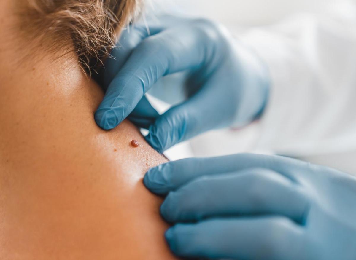 Pénurie de dermatologues : la SFD fait des propositions pour résoudre la crise en France 