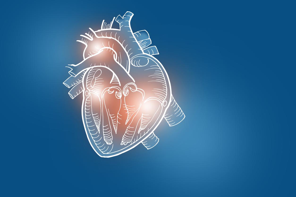 Infarctus du myocarde : remise en cause de l’intérêt de la colchicine en prévention secondaire