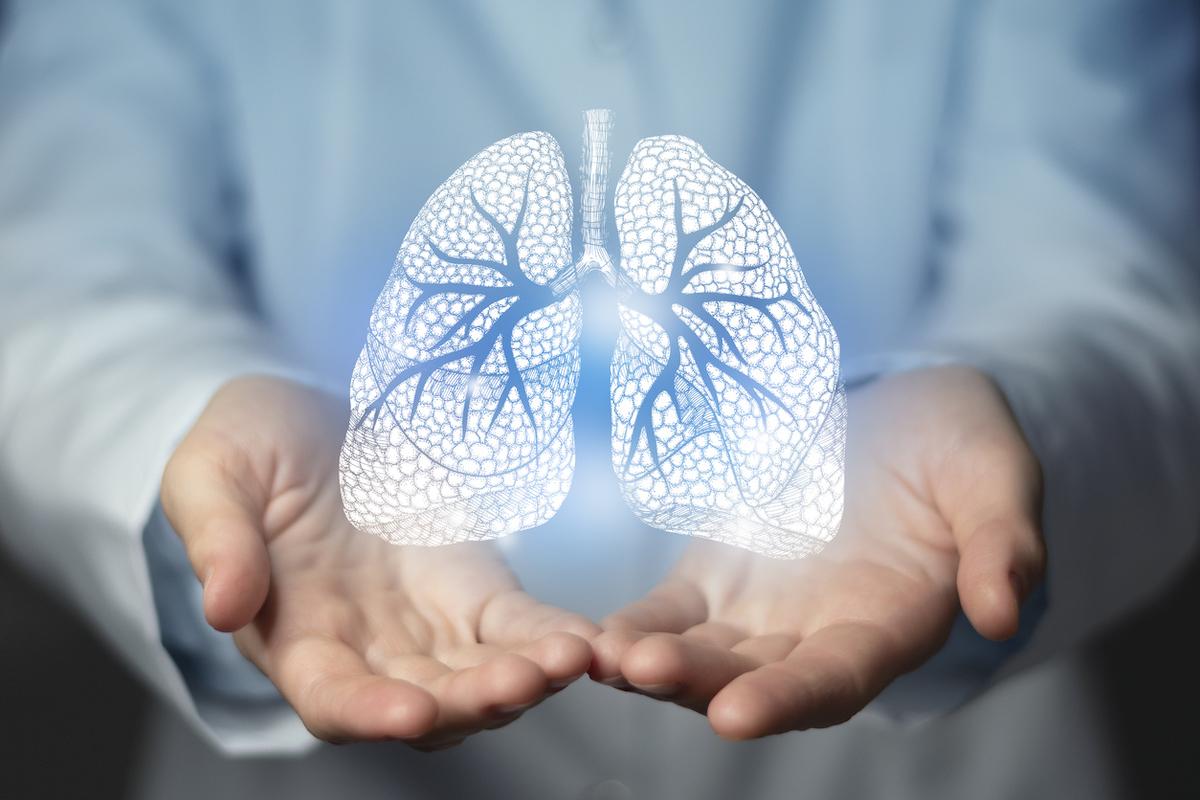 BPCO : vers un diagnostic plus précoce intégrant l’imagerie