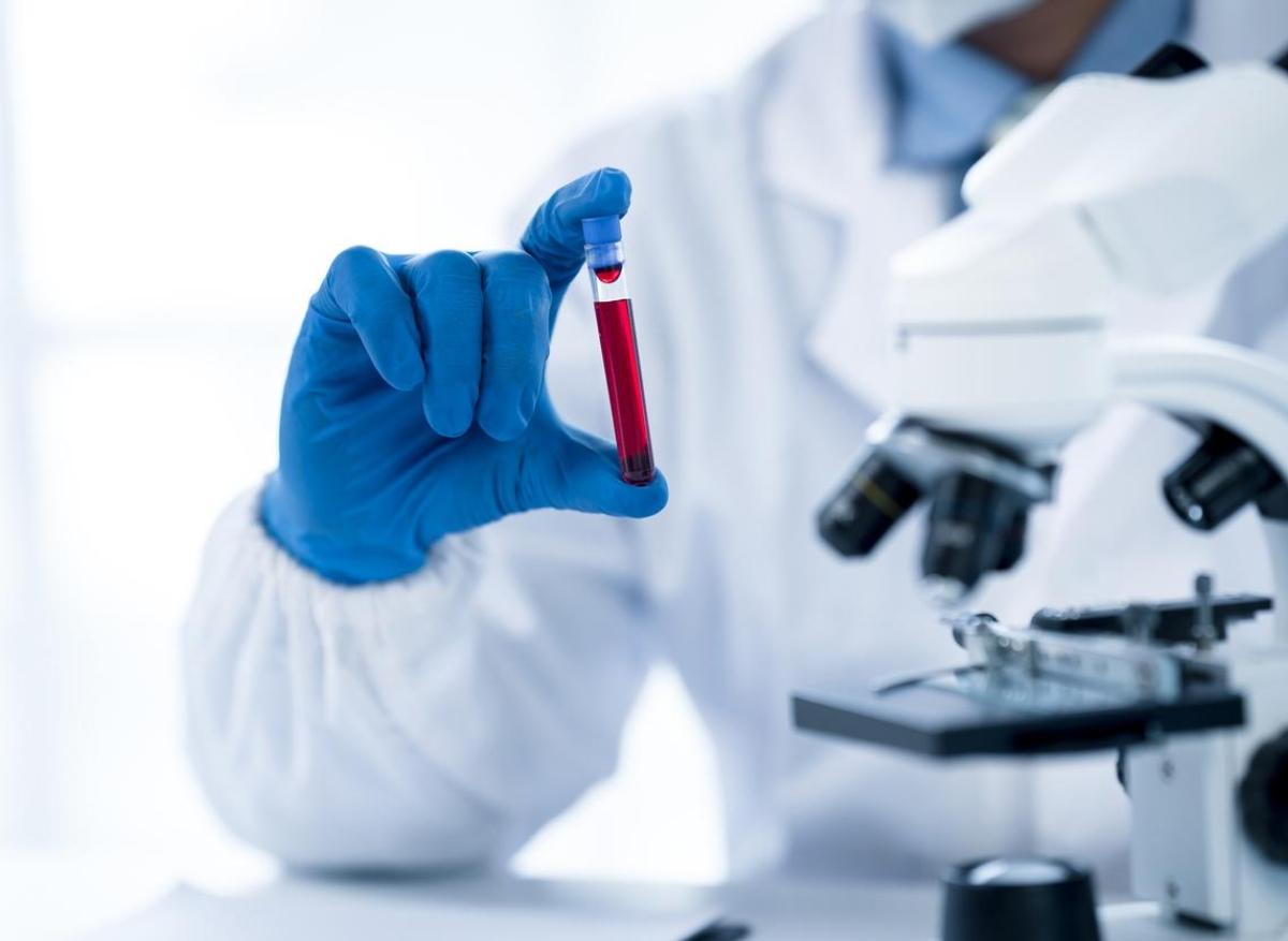 MICI : un test sanguin pour les prédire des années avant la maladie