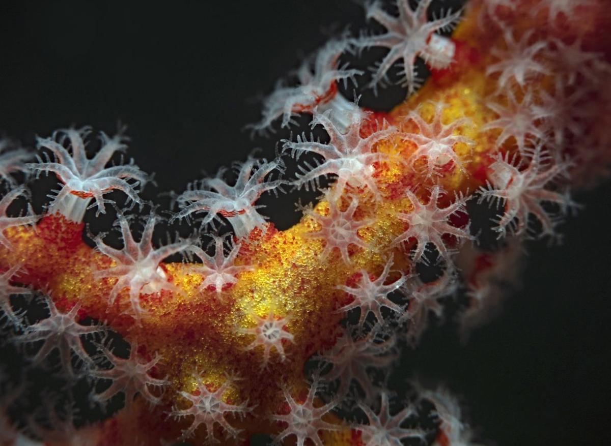 Coloscopie : meilleure classification pronostique des polypes 