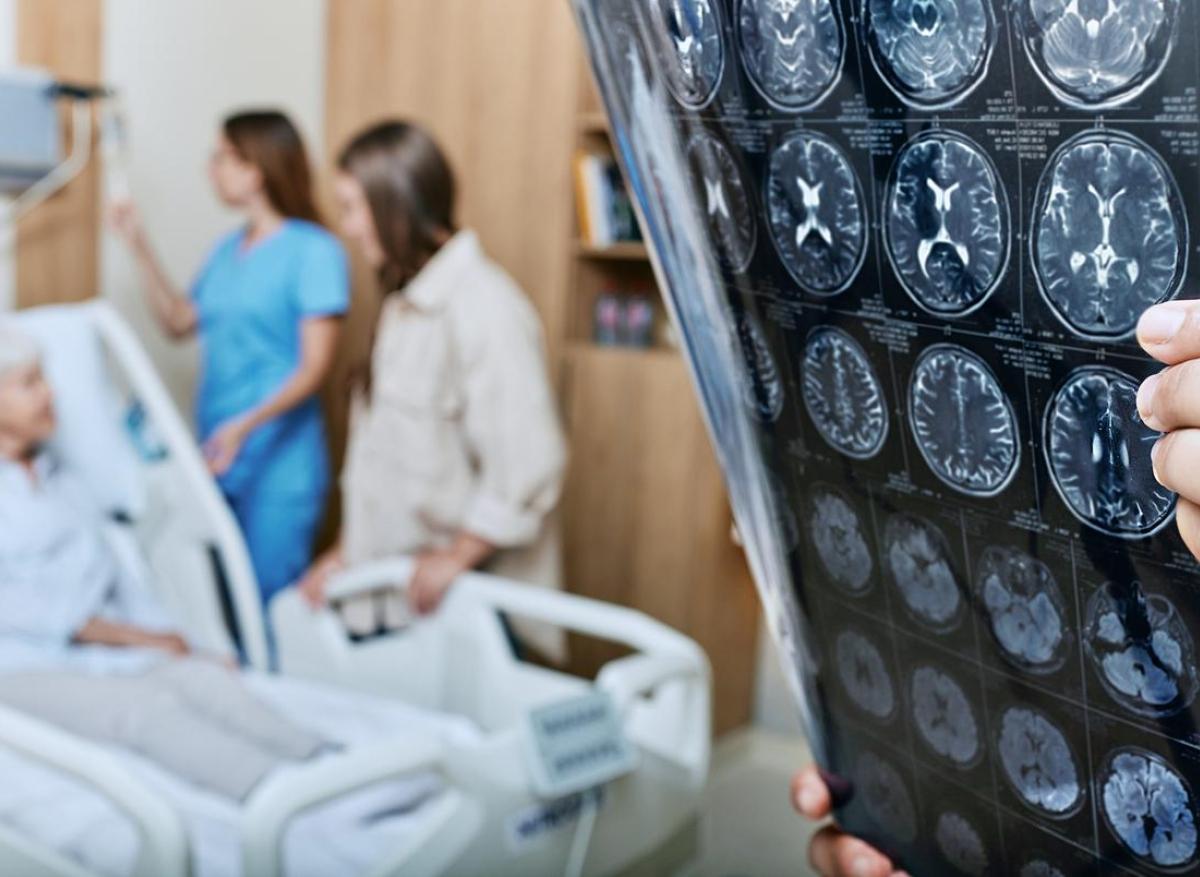 AVC : plus d’hospitalisations dans certains départements français 