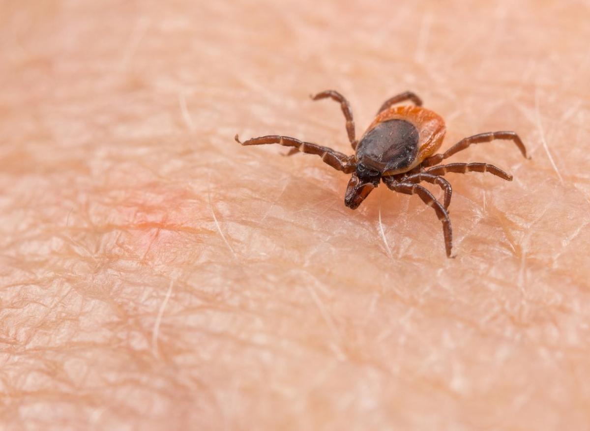 Maladie de Lyme : les nouvelles recommandations de la HAS ne satisfont pas les associations de malades