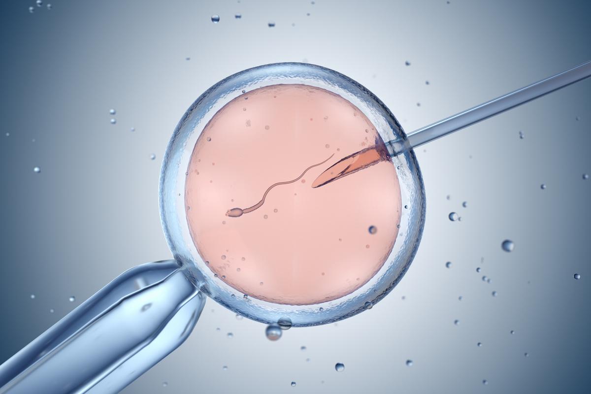 Sclérose en plaques : risque de poussée et fécondation in-vitro