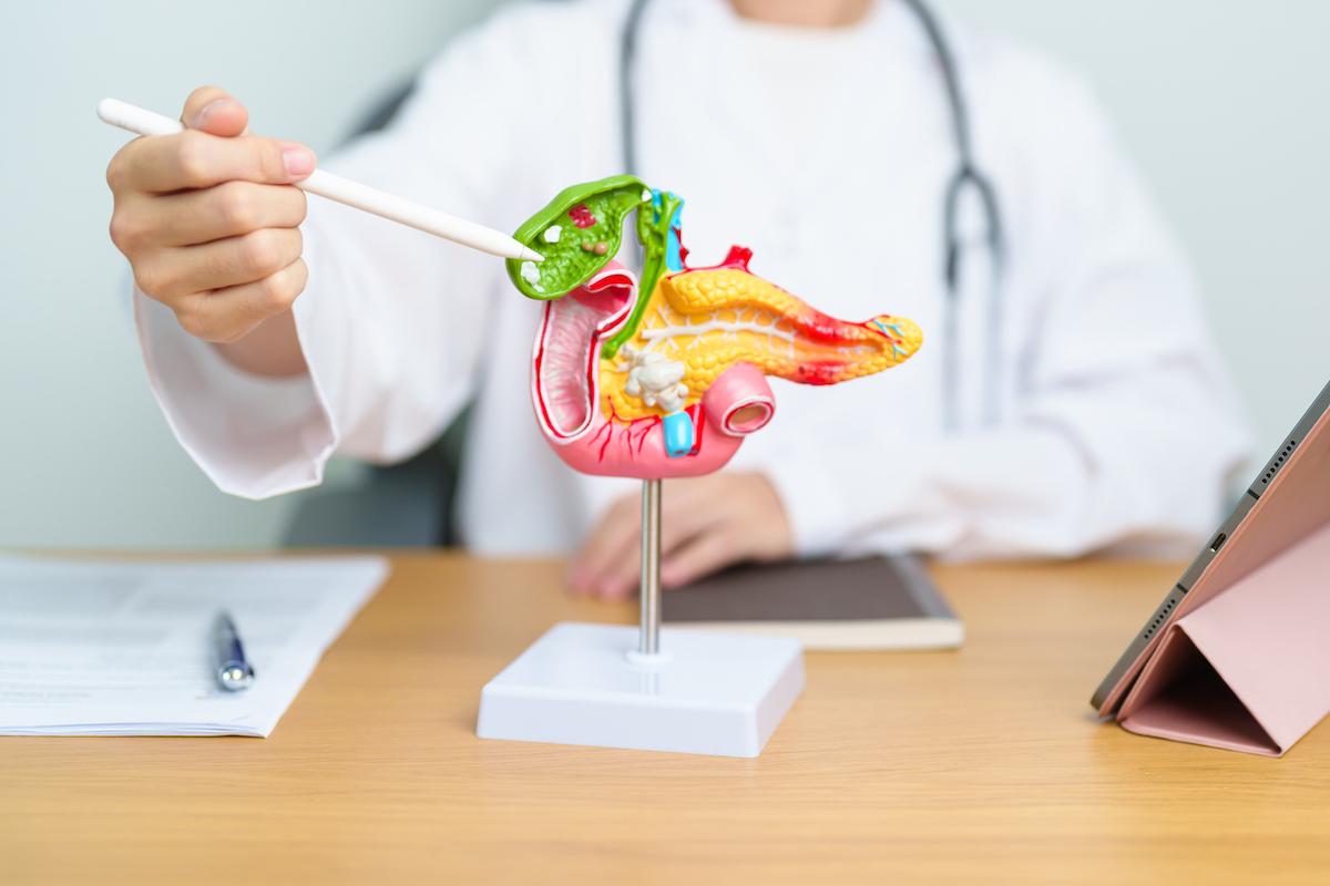 Hyperchylomicronémie persistante : la révolution des ARN interférents