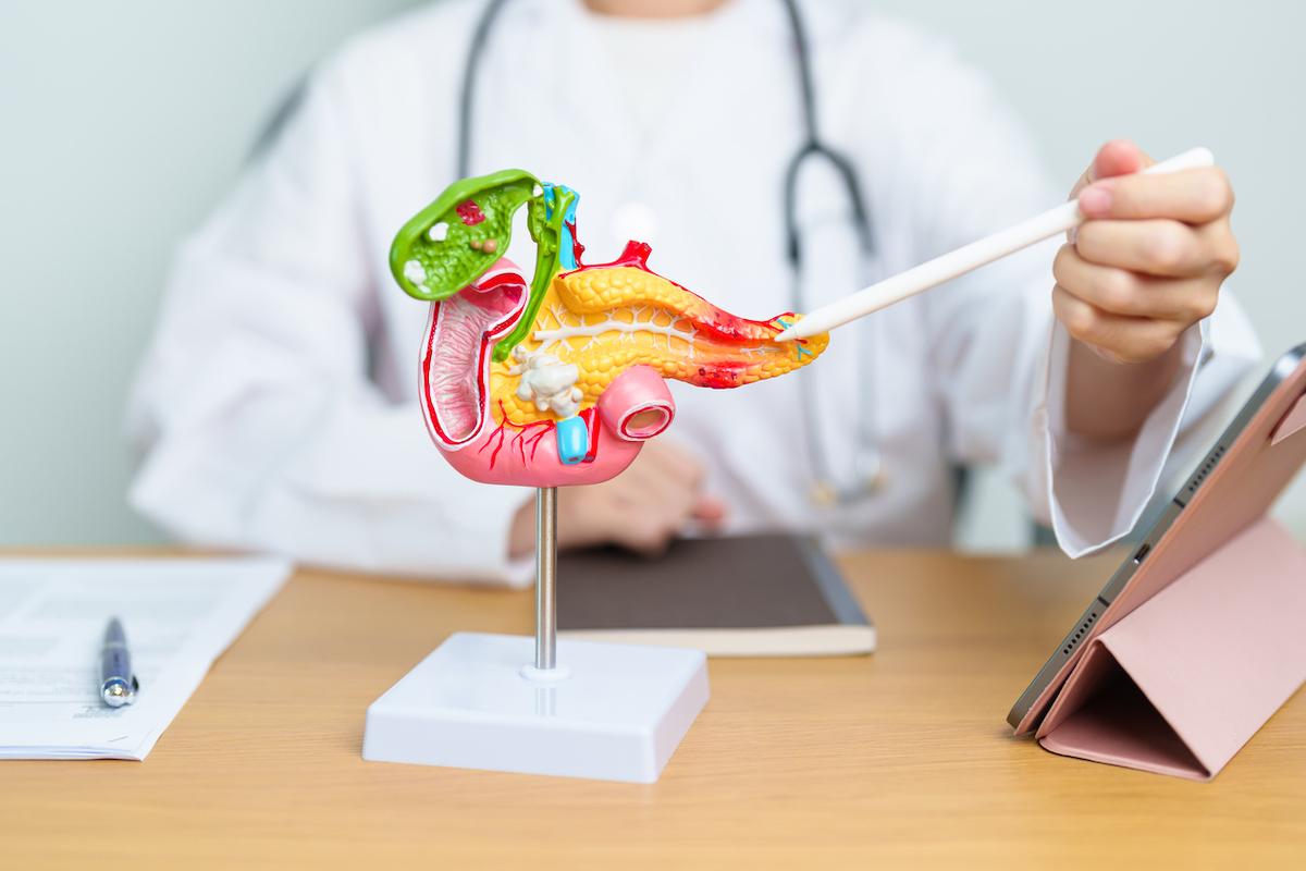 Cancer du pancréas : l’immunothérapie peut booster l’efficacité des inhibiteurs de KRAS
