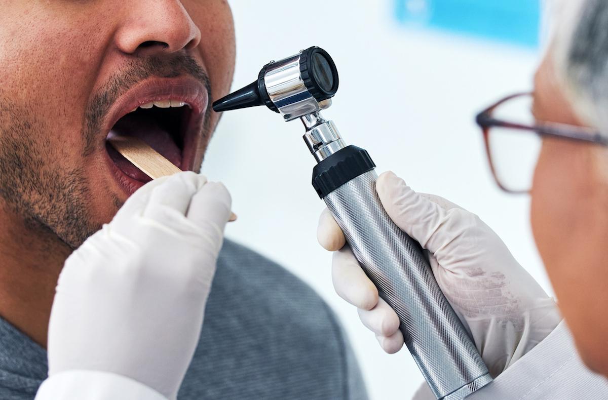 Carcinomes épidermoïdes ORL : un nouveau biomarqueur de bon pronostic 