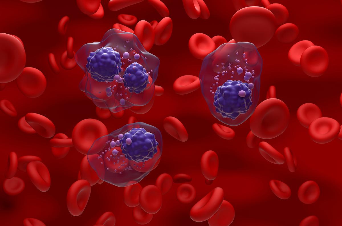 Myélome multiple non éligibles à la greffe : la quadruplette Isa-VRd supérieure au VRd 