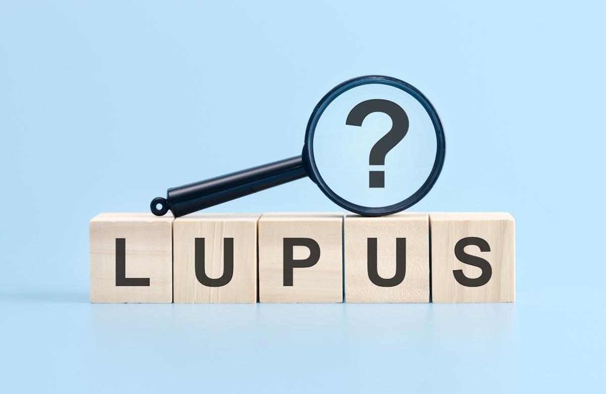 Lupus : repenser les seuils de corticoïdes pour réduire les risques de rechute