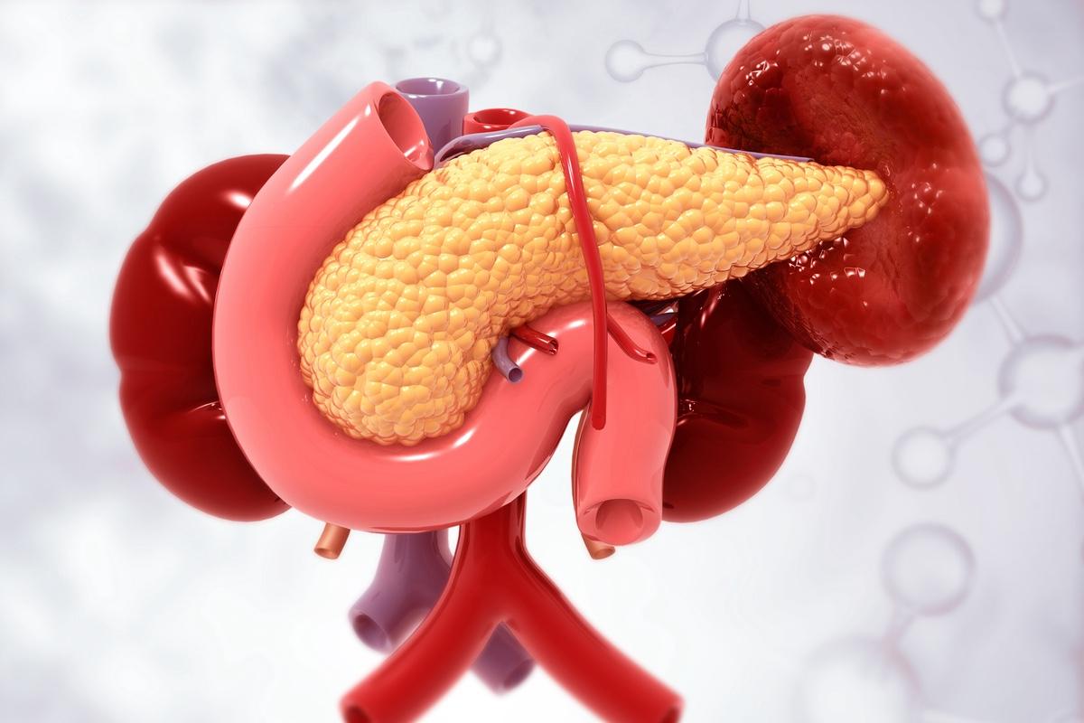Adénocarcinome du pancréas résécable : résultats encourageants de l’étude française PANACHE01
