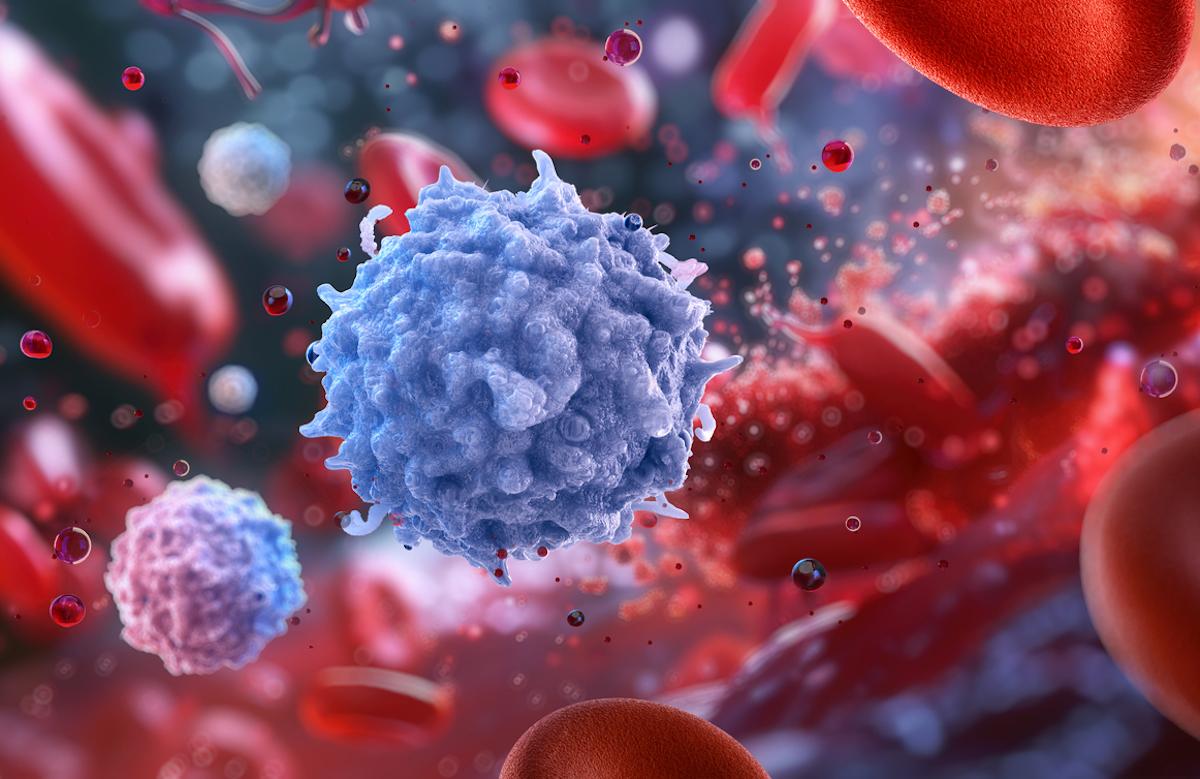 LLC : résultats à long-terme de la combinaison Obinutuzumab-Chlorambucil