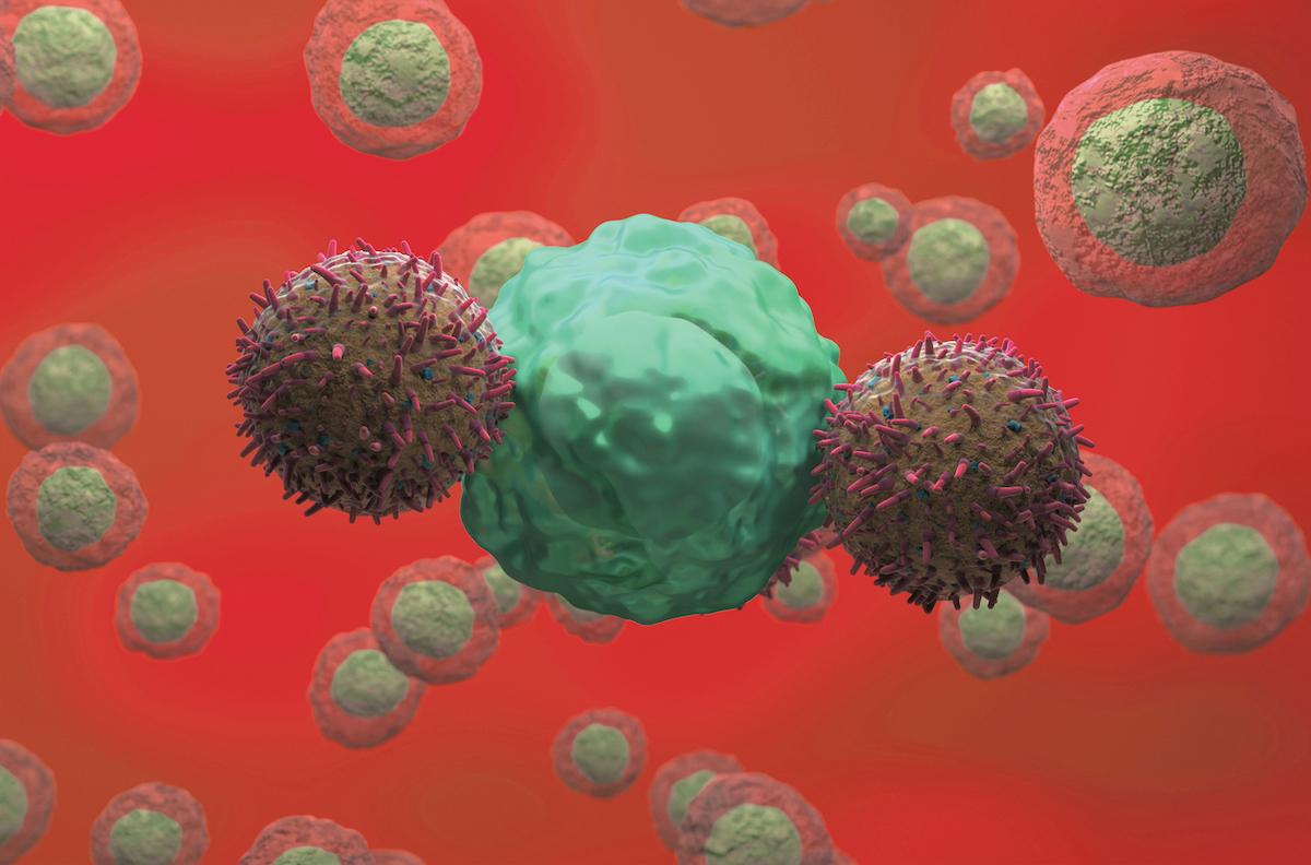 Lymphome B diffus à grandes cellules : axi-cel en première ligne pour les formes à haut risque ?