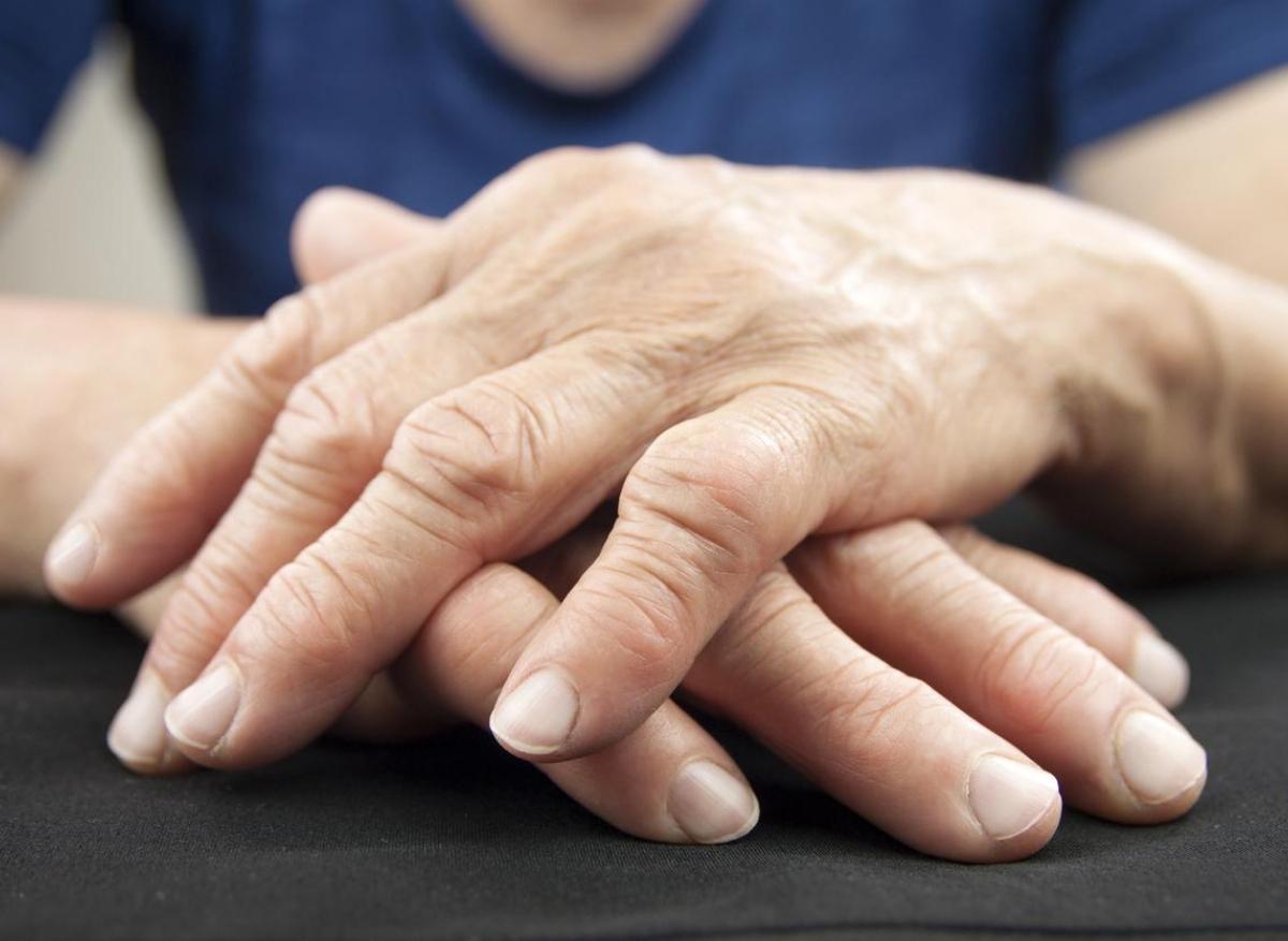 Polyarthrite rhumatoïde : régime végétal, sport et gestion du stress réduisent les symptômes
