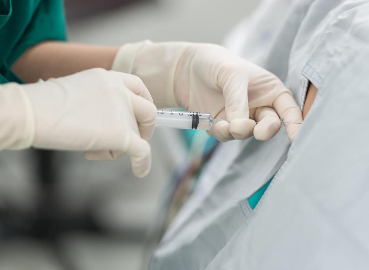 Péridurale : baisse des complications graves après l'accouchement