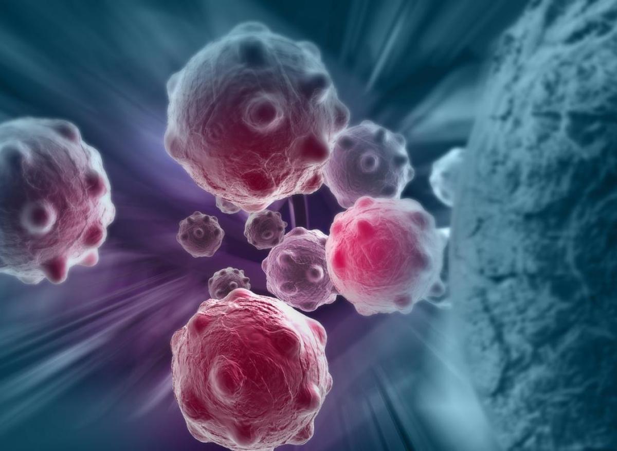 Glioblastome : les fibroblastes périvasculaires cérébraux pourraient améliorer le traitement