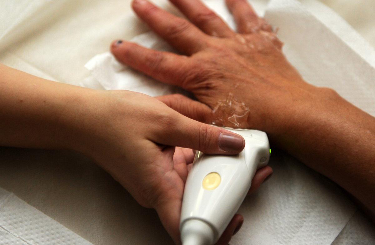 Polyarthrite rhumatoïde : une CRP normale n’exclut pas le diagnostic de poussée inflammatoire