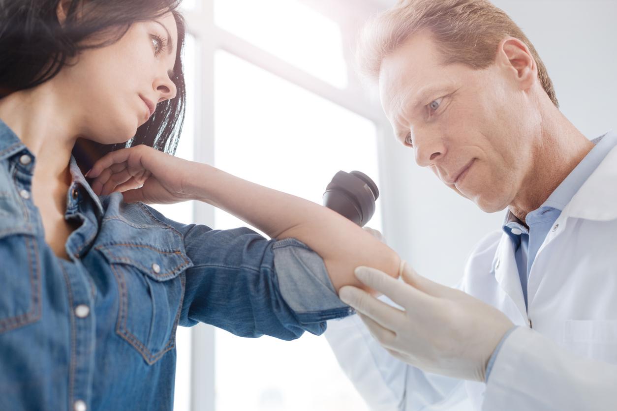 Carcinome à cellule de Merkel métastatique : avelumab confirmé en 1ère ligne pour améliorer la survie globale