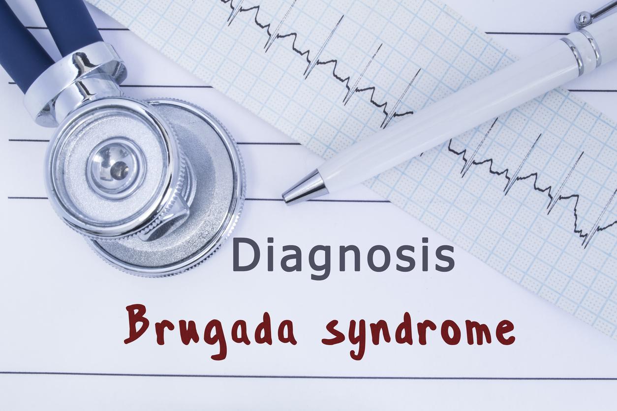 Syndrome de Brugada : bénéfice à long terme du défibrillateur implantable sous-cutané 