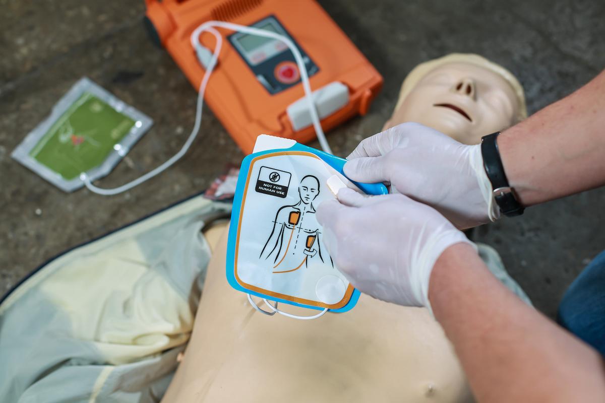 Arrêts cardiaques extra-hospitaliers : l’enjeu de la position des électrodes de défibrillation 
