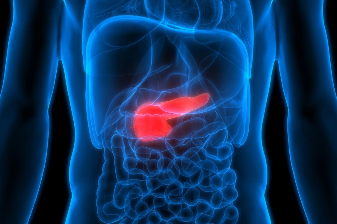 Adénocarcinome pancréatique métastatique : quel traitement de 1ère ligne pour le sujet âgé ?