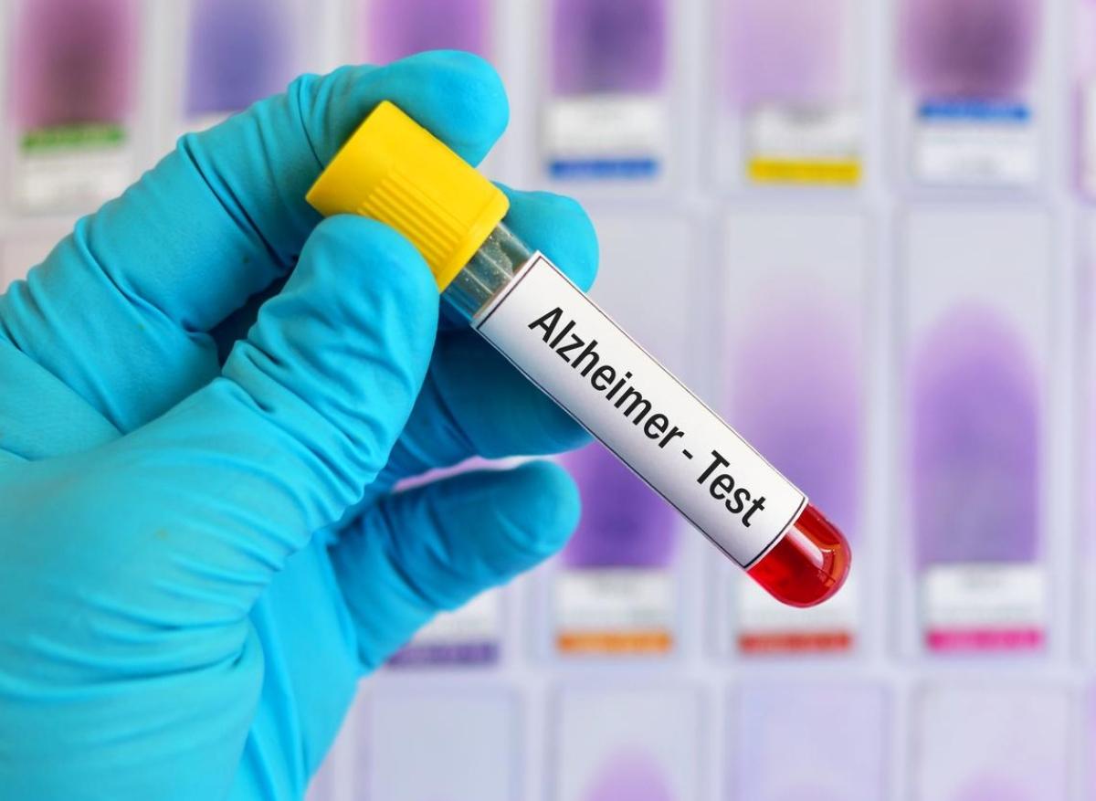 Maladie d'Alzheimer : bientôt un test sanguin de dépistage précoce?