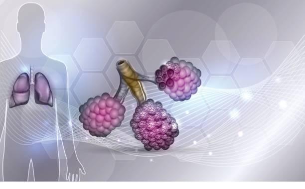 Emphysème : la force et la forme du diaphragme améliorées par la réduction de volume par valves endobronchiques