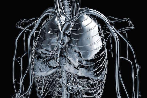 La radiothérapie stéréotaxique fait aussi bien que la chirurgie pour le traitement des métastases pulmonaires