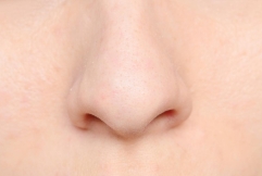Formes localisées de lymphome NK/T extranodal : efficacité d’une combinaison chimio-radiothérapie
