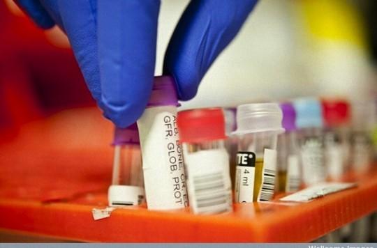 L'intestin : une nouvelle cible thérapeutique contre le diabète