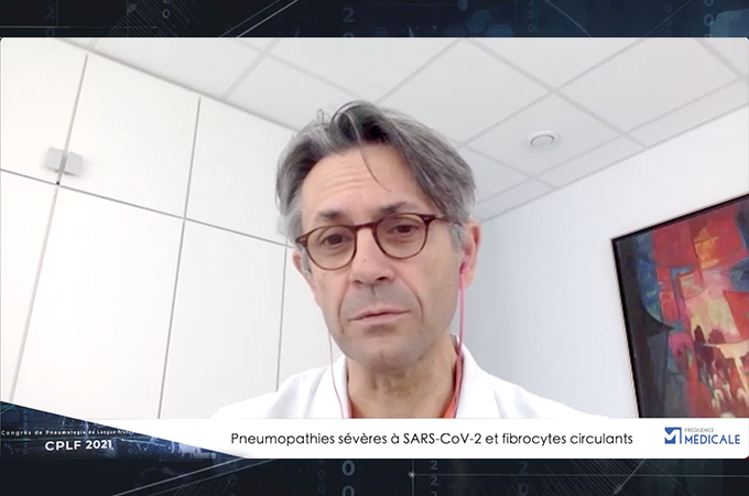 Pneumopathies sévères à SARS-cov-2 et fibrocytes circulants