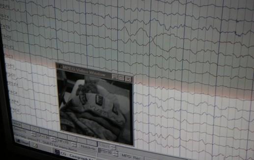 Epilepsie : “Les généralistes doivent collaborer avec les neurologues”